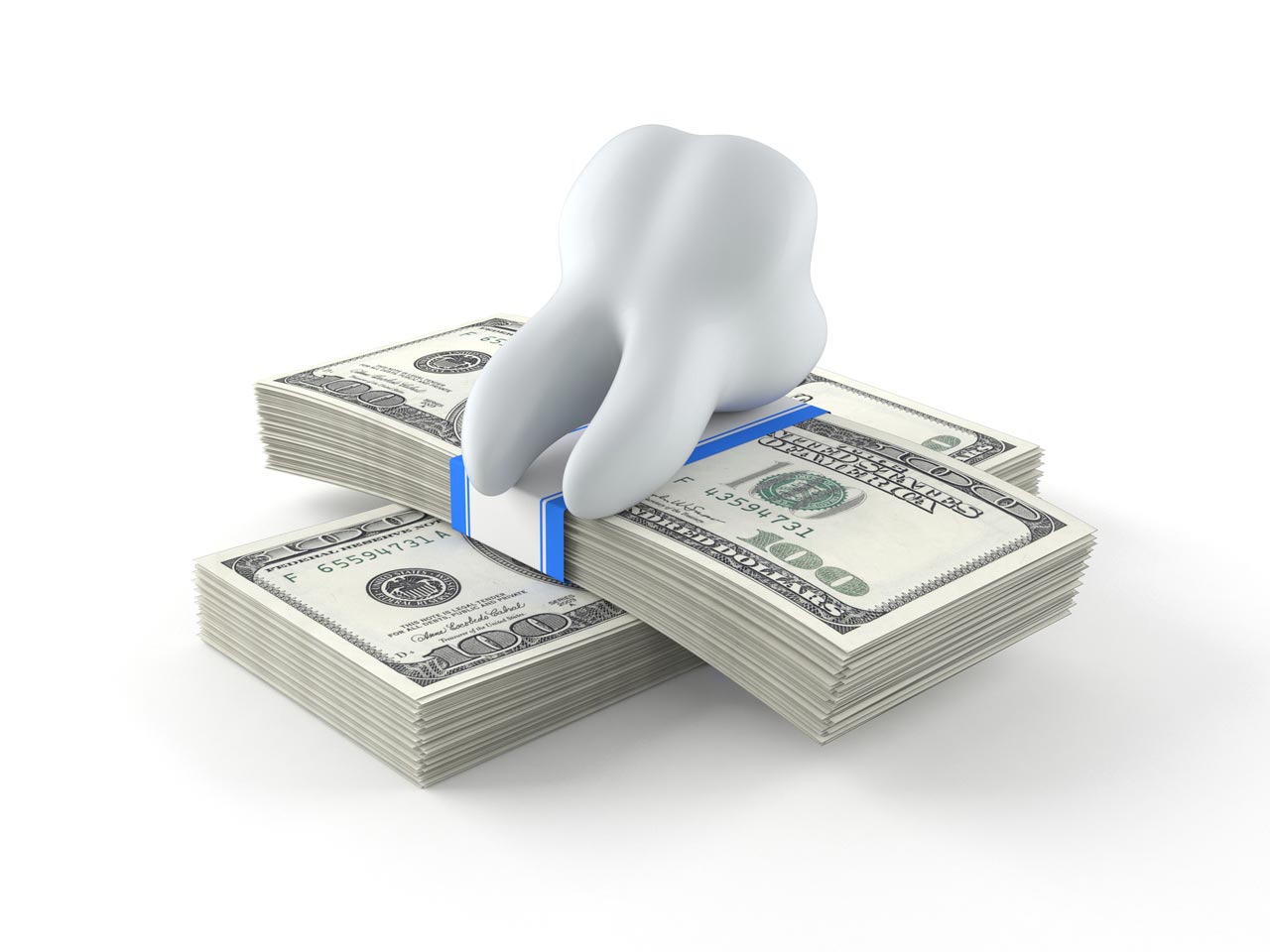 Wisdom Teeth Removal Cost in Sydney