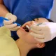 Wisdom teeth removal recovery with dentist treating young woman after oral surgery